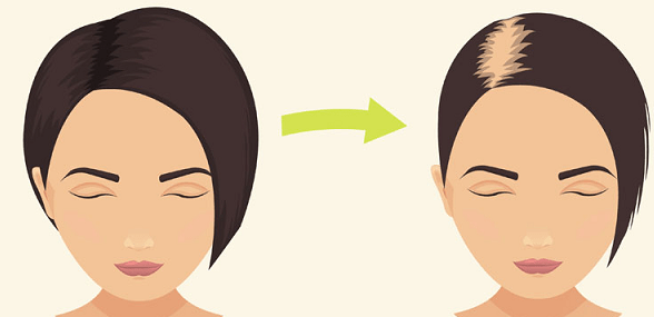Best remedies for Hair Fall